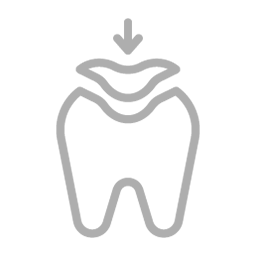 Emax Dental Veneer