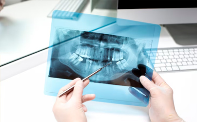 Oral Diagnoz: Optimal Mundgesundheit - Vitaler Schritt